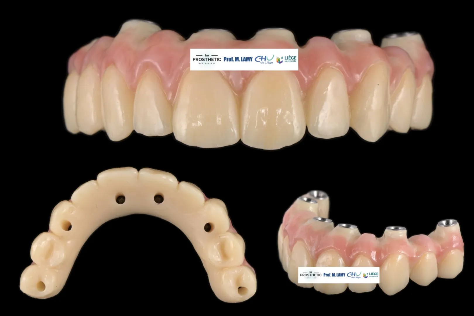 Pr Marc LAMY - Prothèse sur implants (BeProsthetic) - NOUVELLE EDITION