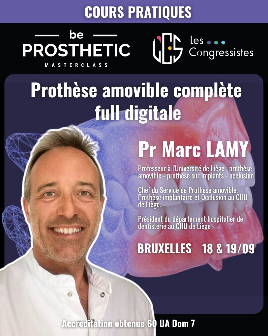 Pr Marc LAMY - Prothèse amovible complète full digitale (BeProsthetic)